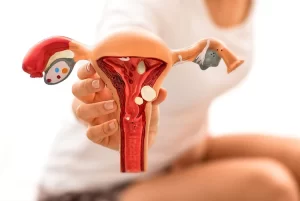 اندومتریوز