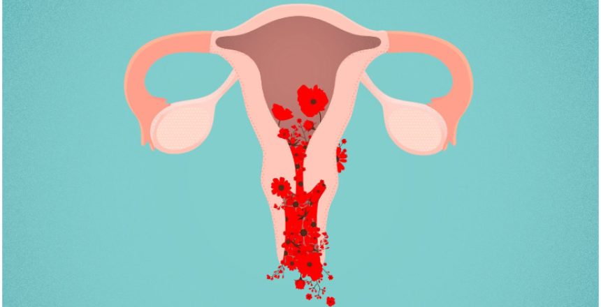 Abnormal-Uterine-Bleeding
